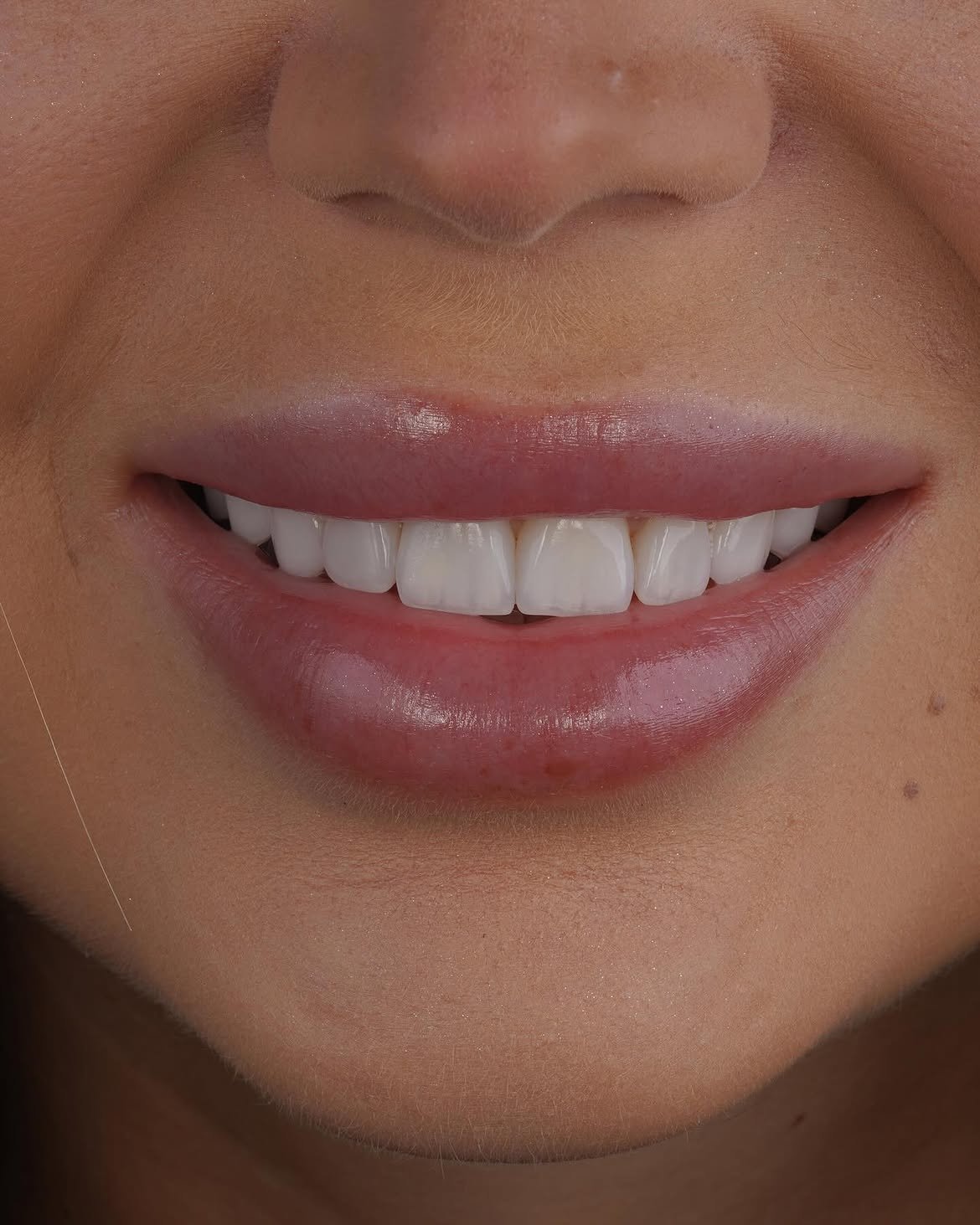 Dentelle Clinic